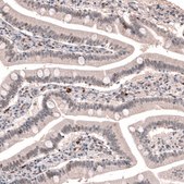 Anti-TET3 antibody produced in rabbit Prestige Antibodies&#174; Powered by Atlas Antibodies, affinity isolated antibody, buffered aqueous glycerol solution