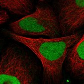Anti-KIF4A antibody produced in rabbit Prestige Antibodies&#174; Powered by Atlas Antibodies, affinity isolated antibody, buffered aqueous glycerol solution