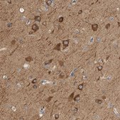 Anti-KLHL11 antibody produced in rabbit Prestige Antibodies&#174; Powered by Atlas Antibodies, affinity isolated antibody, buffered aqueous glycerol solution