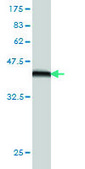 Monoclonal Anti-T antibody produced in mouse clone 5H8, purified immunoglobulin, buffered aqueous solution