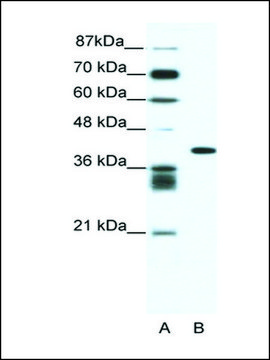 Anti-ALX4 (AB2) antibody produced in rabbit affinity isolated antibody
