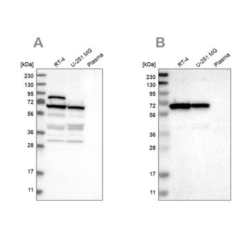 Anti-NOP58 antibody produced in rabbit Prestige Antibodies&#174; Powered by Atlas Antibodies, affinity isolated antibody, buffered aqueous glycerol solution