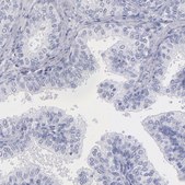 Anti-MB antibody produced in rabbit Prestige Antibodies&#174; Powered by Atlas Antibodies, affinity isolated antibody, buffered aqueous glycerol solution