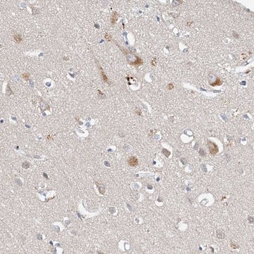 Anti-CARMIL3 antibody produced in rabbit Prestige Antibodies&#174; Powered by Atlas Antibodies, affinity isolated antibody, buffered aqueous glycerol solution