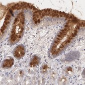 Anti-IFNGR2 antibody produced in rabbit affinity isolated antibody, buffered aqueous glycerol solution