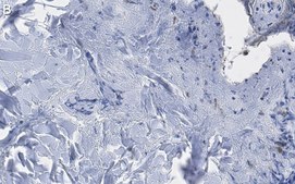 Anti-Collagen Type III Antibody, clone 3N18 ZooMAb&#174; Rabbit Monoclonal recombinant, expressed in HEK 293 cells