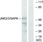 Anti-SAPK antibody produced in rabbit affinity isolated antibody
