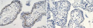 Anti-Laminin &#946;1 Antibody, clone 4E10 ZooMAb&#174; Mouse Monoclonal recombinant, expressed in HEK 293 cells