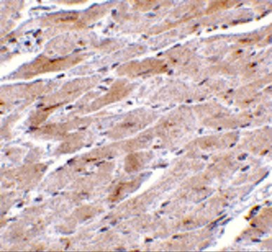 Anti-TRPC3 antibody produced in rabbit affinity isolated antibody