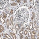 Anti-SLC36A4 antibody produced in rabbit Prestige Antibodies&#174; Powered by Atlas Antibodies, affinity isolated antibody, buffered aqueous glycerol solution