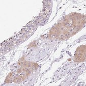 Anti-HSD17B3 antibody produced in rabbit Prestige Antibodies&#174; Powered by Atlas Antibodies, affinity isolated antibody, buffered aqueous glycerol solution