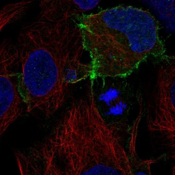 Anti-KIT antibody produced in rabbit Prestige Antibodies&#174; Powered by Atlas Antibodies, affinity isolated antibody