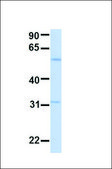 Anti-ACVR1 antibody produced in rabbit affinity isolated antibody