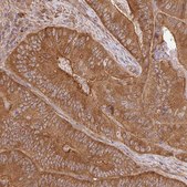 Anti-GSPT1 antibody produced in rabbit Prestige Antibodies&#174; Powered by Atlas Antibodies, affinity isolated antibody, buffered aqueous glycerol solution