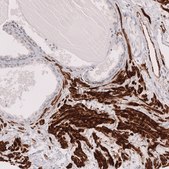 Monoclonal Anti-Myh11 Antibody Produced In Mouse Prestige Antibodies&#174; Powered by Atlas Antibodies, clone CL14619, affinity isolated antibody, buffered aqueous glycerol solution