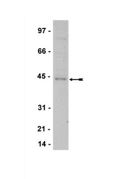 Anti-TTF-1 Antibody serum, Upstate&#174;