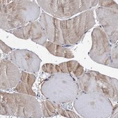 Anti-LCP2 antibody produced in rabbit Prestige Antibodies&#174; Powered by Atlas Antibodies, affinity isolated antibody, buffered aqueous glycerol solution