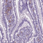 Monoclonal Anti-ITGAX antibody produced in mouse Prestige Antibodies&#174; Powered by Atlas Antibodies, clone CL1831, purified immunoglobulin, buffered aqueous glycerol solution