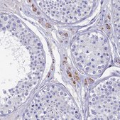 Anti-OAT antibody produced in rabbit Prestige Antibodies&#174; Powered by Atlas Antibodies, affinity isolated antibody, buffered aqueous glycerol solution