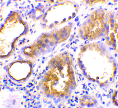 Anti-ACE2 antibody produced in rabbit affinity isolated antibody, buffered aqueous solution