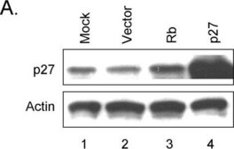 Anti-Actin antibody produced in rabbit affinity isolated antibody, buffered aqueous solution