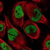 Anti-CAD antibody produced in rabbit Prestige Antibodies&#174; Powered by Atlas Antibodies, affinity isolated antibody