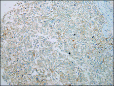 Anti-IL3RA affinity isolated antibody