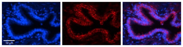 Anti-RPLP0 (AB1) antibody produced in rabbit affinity isolated antibody