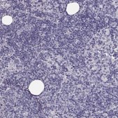 Anti-KRT31 antibody produced in rabbit Prestige Antibodies&#174; Powered by Atlas Antibodies, affinity isolated antibody, buffered aqueous glycerol solution