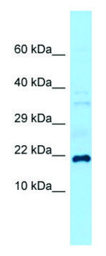 Anti-Grem1 (C-terminal) antibody produced in rabbit affinity isolated antibody