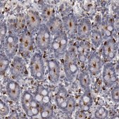 Anti-STX3 antibody produced in rabbit Prestige Antibodies&#174; Powered by Atlas Antibodies, affinity isolated antibody, buffered aqueous glycerol solution