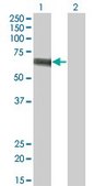 Monoclonal Anti-SLC5A2 antibody produced in mouse clone 3G8, purified immunoglobulin, buffered aqueous solution
