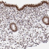 Anti-UBE2E3 antibody produced in rabbit Prestige Antibodies&#174; Powered by Atlas Antibodies, affinity isolated antibody, buffered aqueous glycerol solution