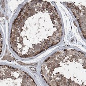 Anti-LIMK1 antibody produced in rabbit Prestige Antibodies&#174; Powered by Atlas Antibodies, affinity isolated antibody, buffered aqueous glycerol solution, ab2