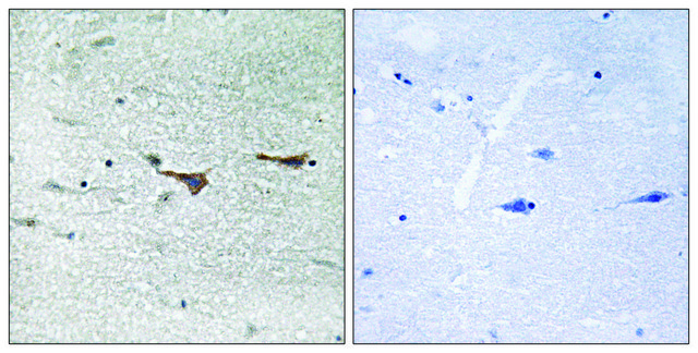 Anti-TOB1 antibody produced in rabbit affinity isolated antibody