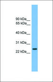 Anti-CHMP4B antibody produced in rabbit affinity isolated antibody