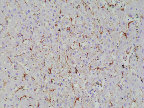 Anti-Caveolin-1 antibody, Rabbit monoclonal recombinant, expressed in HEK 293 cells, clone RM325, purified immunoglobulin