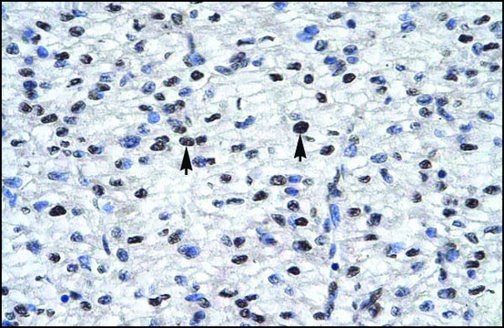Anti-GLI2 IgG fraction of antiserum