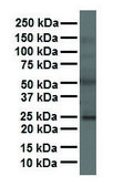 Anti-FOLR1 antibody produced in rabbit affinity isolated antibody