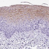 Anti-MUC21 antibody produced in rabbit Prestige Antibodies&#174; Powered by Atlas Antibodies, affinity isolated antibody, buffered aqueous glycerol solution