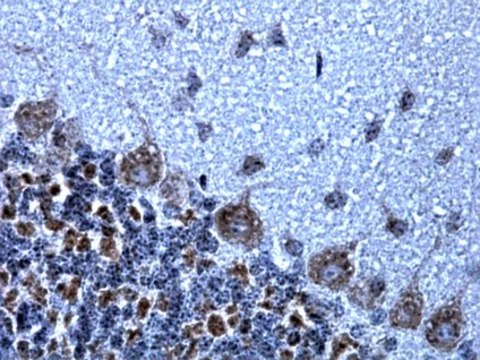 Anti-NMDAR1 Antibody, clone 1.17.2.6, rabbit monoclonal clone 1.17.2.6, from rabbit, unconjugated