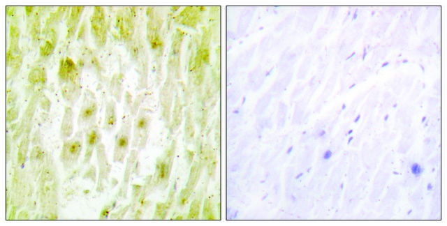 Anti-TF2E2 antibody produced in rabbit affinity isolated antibody
