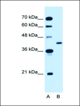 Anti-GOT2 (AB1) antibody produced in rabbit IgG fraction of antiserum