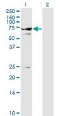 Monoclonal Anti-STXBP1 antibody produced in mouse clone 6D1, purified immunoglobulin, buffered aqueous solution