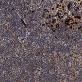 Anti-RECQL antibody produced in rabbit Prestige Antibodies&#174; Powered by Atlas Antibodies, affinity isolated antibody, buffered aqueous glycerol solution