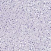 Anti-TNNT2 antibody produced in rabbit Prestige Antibodies&#174; Powered by Atlas Antibodies, affinity isolated antibody, buffered aqueous glycerol solution