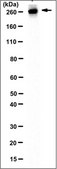 Anti-Fibronectin (Cell Attachment Fragment) Antibody, clone 3E3, Ascites &amp; Azide Free clone 3E3, from mouse