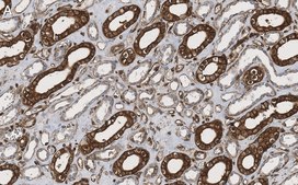 Anti-phospho-TSC2-Ser939 Antibody, clone 1G19 ZooMAb&#174; Rabbit Monoclonal recombinant, expressed in HEK 293 cells