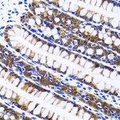 Anti-Fatty Acid Synthase antibody produced in rabbit