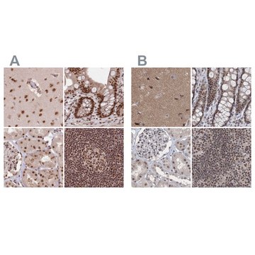 Anti-PDS5A antibody produced in rabbit Prestige Antibodies&#174; Powered by Atlas Antibodies, affinity isolated antibody, buffered aqueous glycerol solution